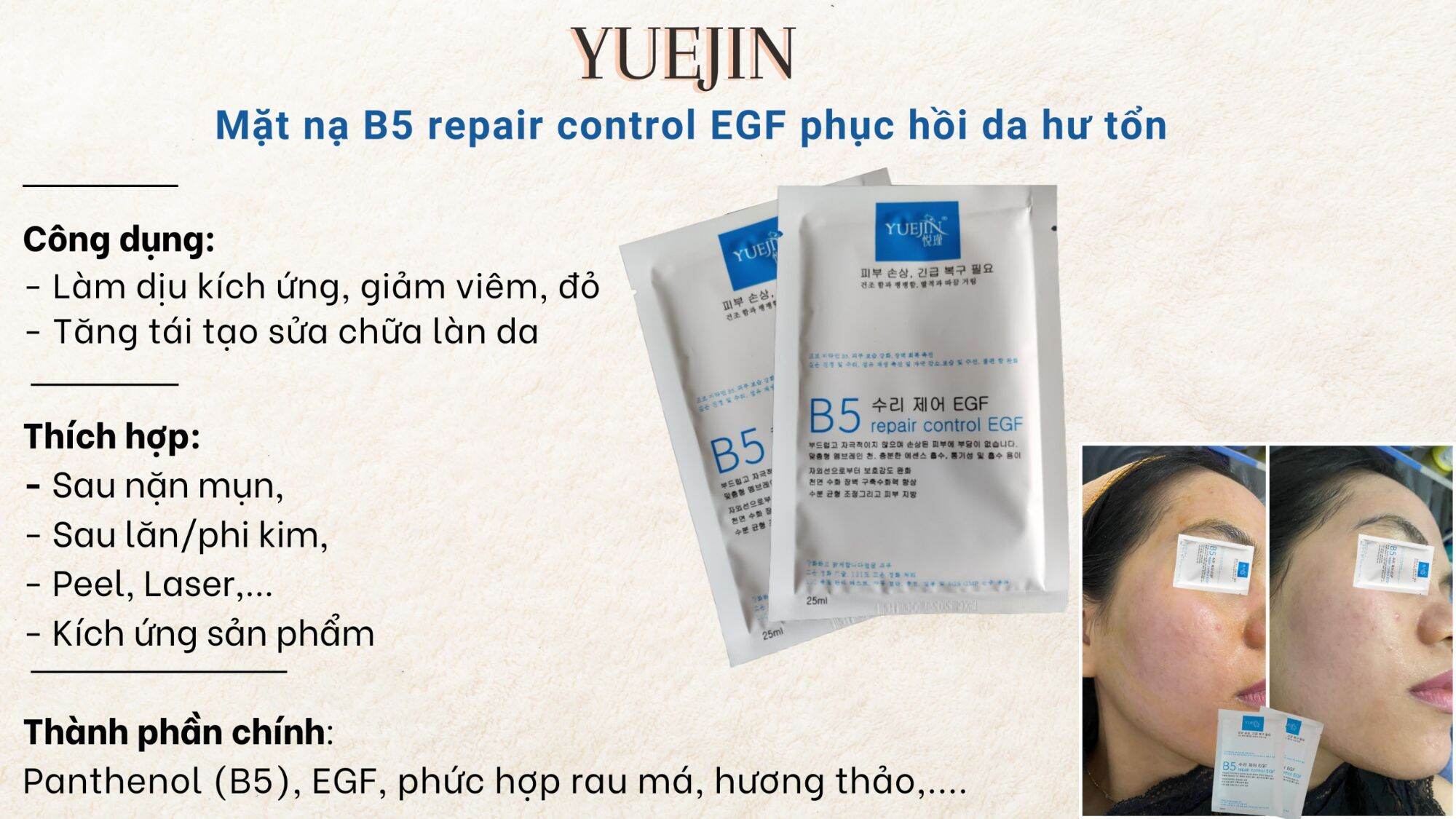 Mặt nạ B5 Repair Control EGF Yuejin cấp ẩm phục hồi da